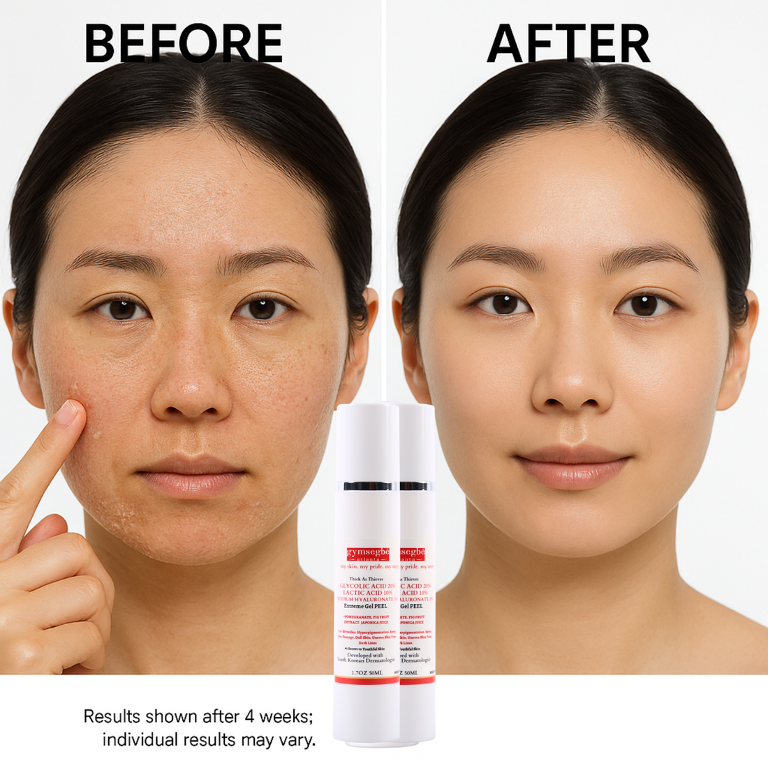 Extreme Glycolic & Lactic Acid Gel Peel, Clinical Exfoliation