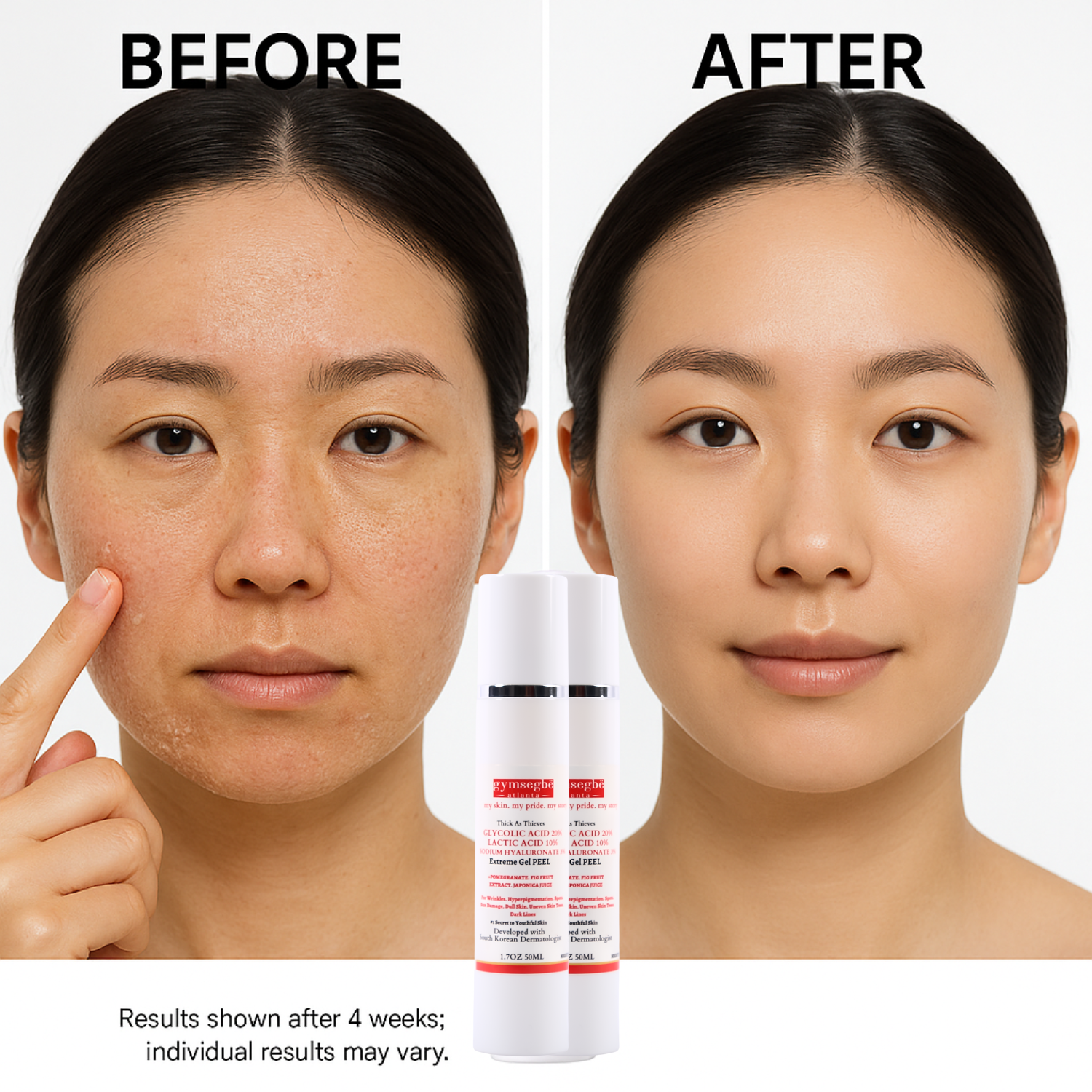Extreme Glycolic & Lactic Acid Gel Peel, Clinical Exfoliation