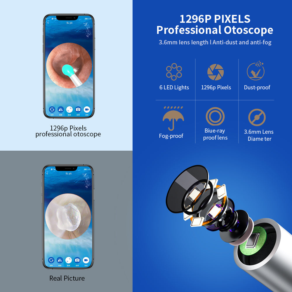 Wireless Ear Otoscope with Camera - HD Ear Wax Removal Tool Kit