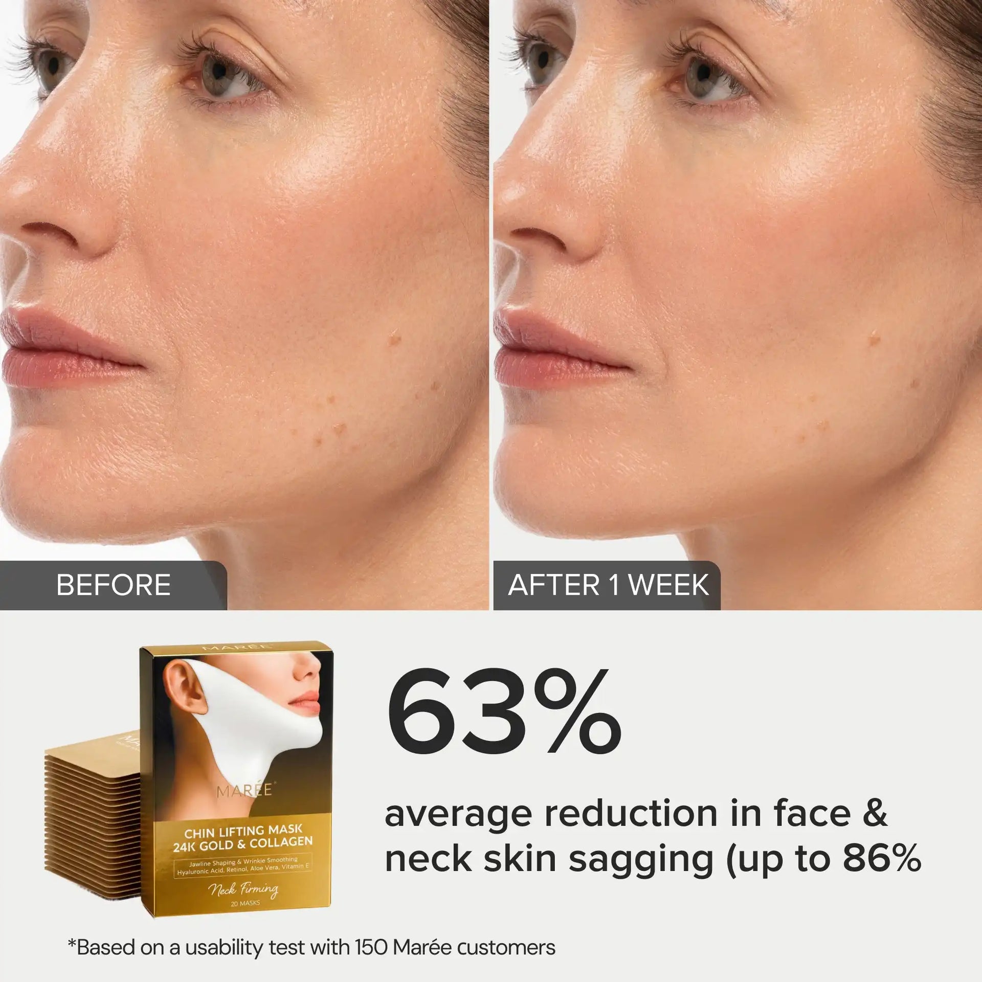 24K Gold Collagen V-Line Lifting Mask for Chin and Neck - 20 PCS - Image 7