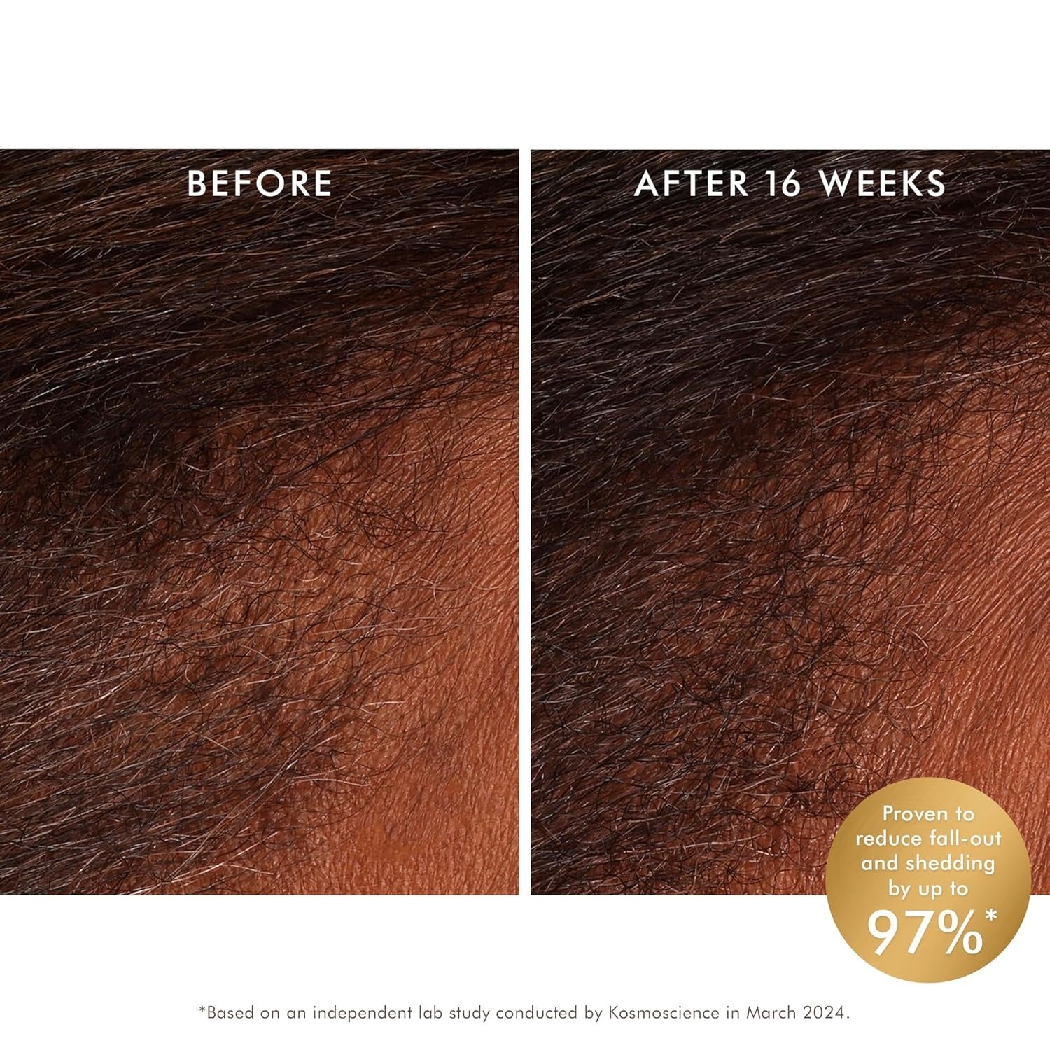 Revitalizing Scalp Tonic Treatment for Thinning Hair 3.4 Oz