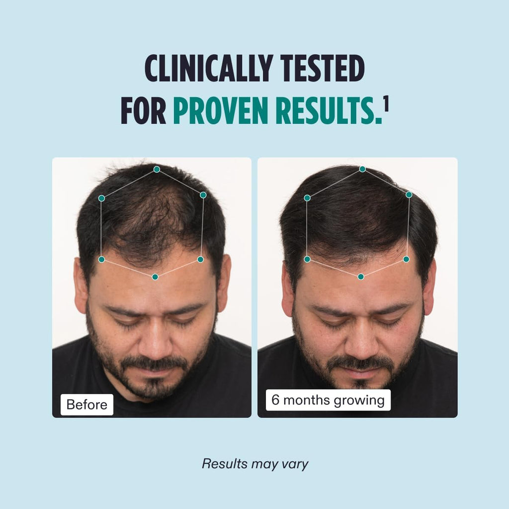 Men's Hair Growth Supplement 3-Month Supply Black and Gold