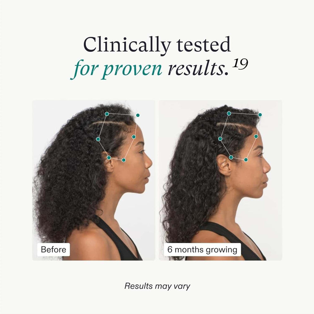 Vegan Hair Growth Supplement 3-Month Supply for Women 18-44