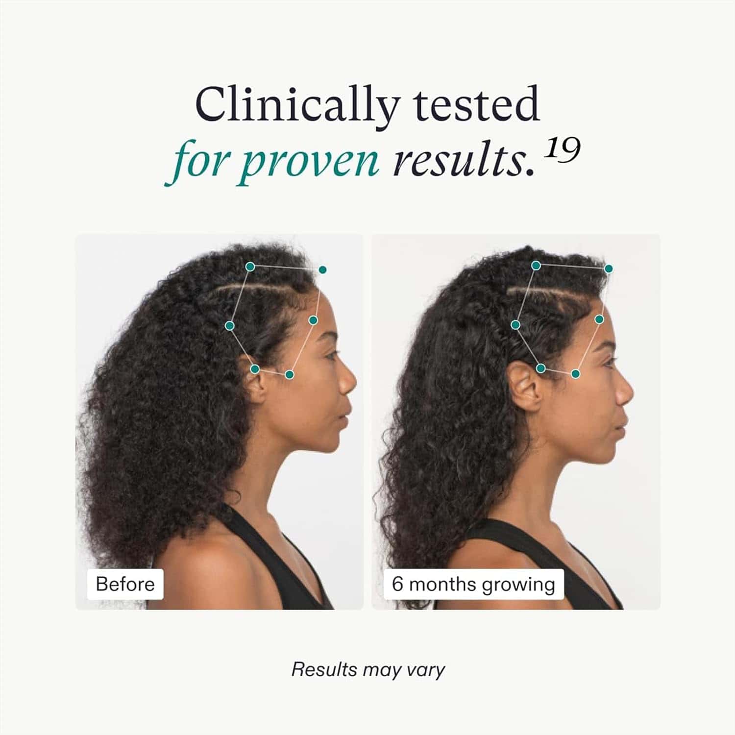 Vegan Hair Growth Supplement 3-Month Supply for Women 18-44