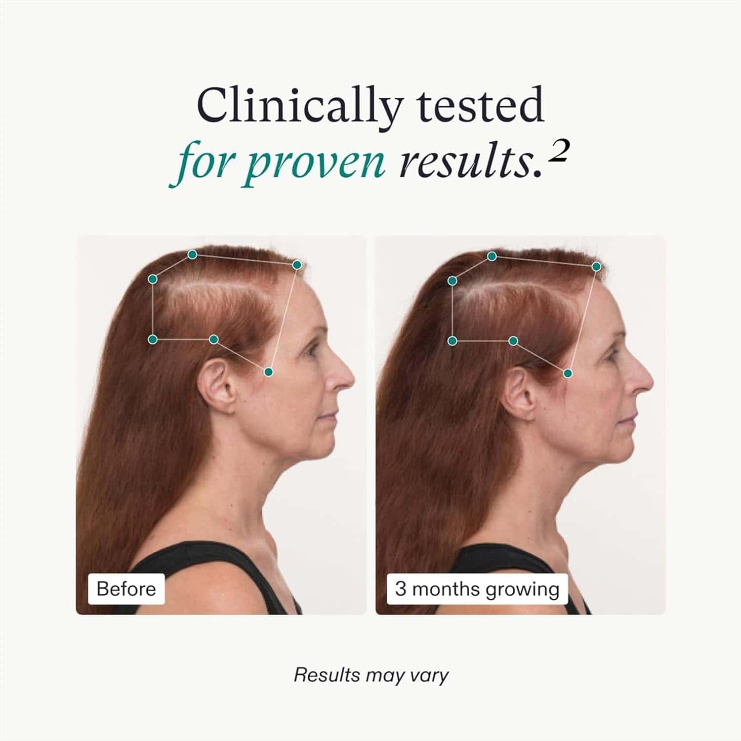 Women's Balance Hair Growth Supplement 3-Month Supply