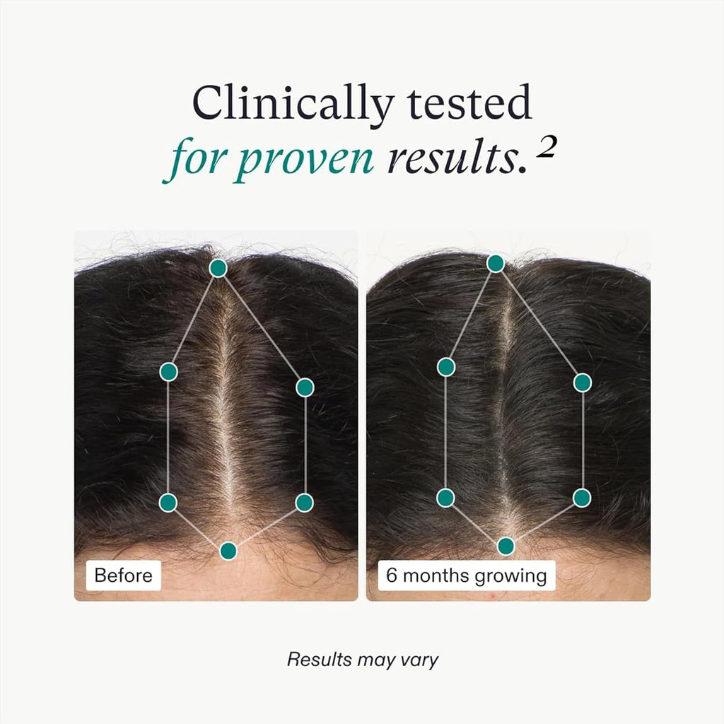 Women's Hair Growth Supplement for Thicker Stronger Hair