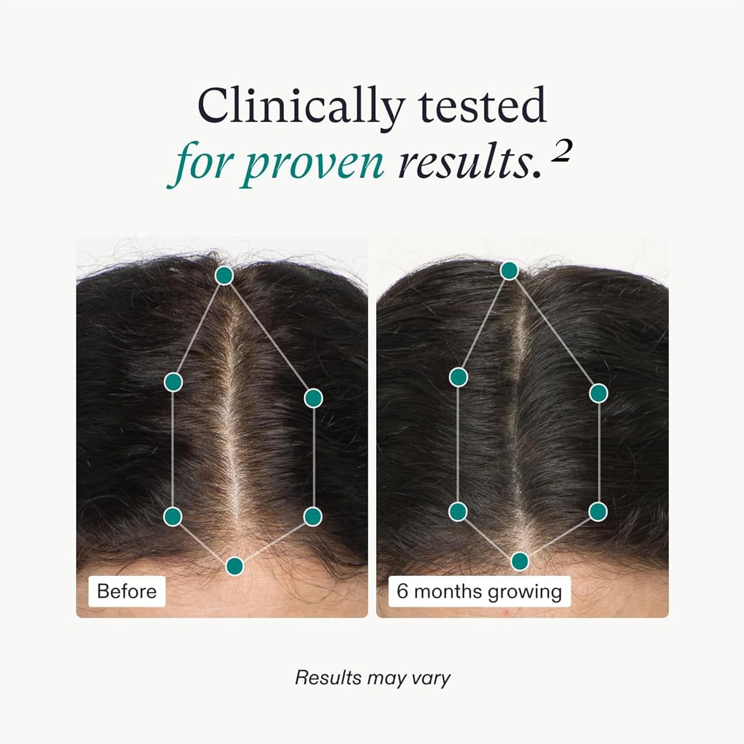 Women's Hair Growth Supplement for Thicker Stronger Hair