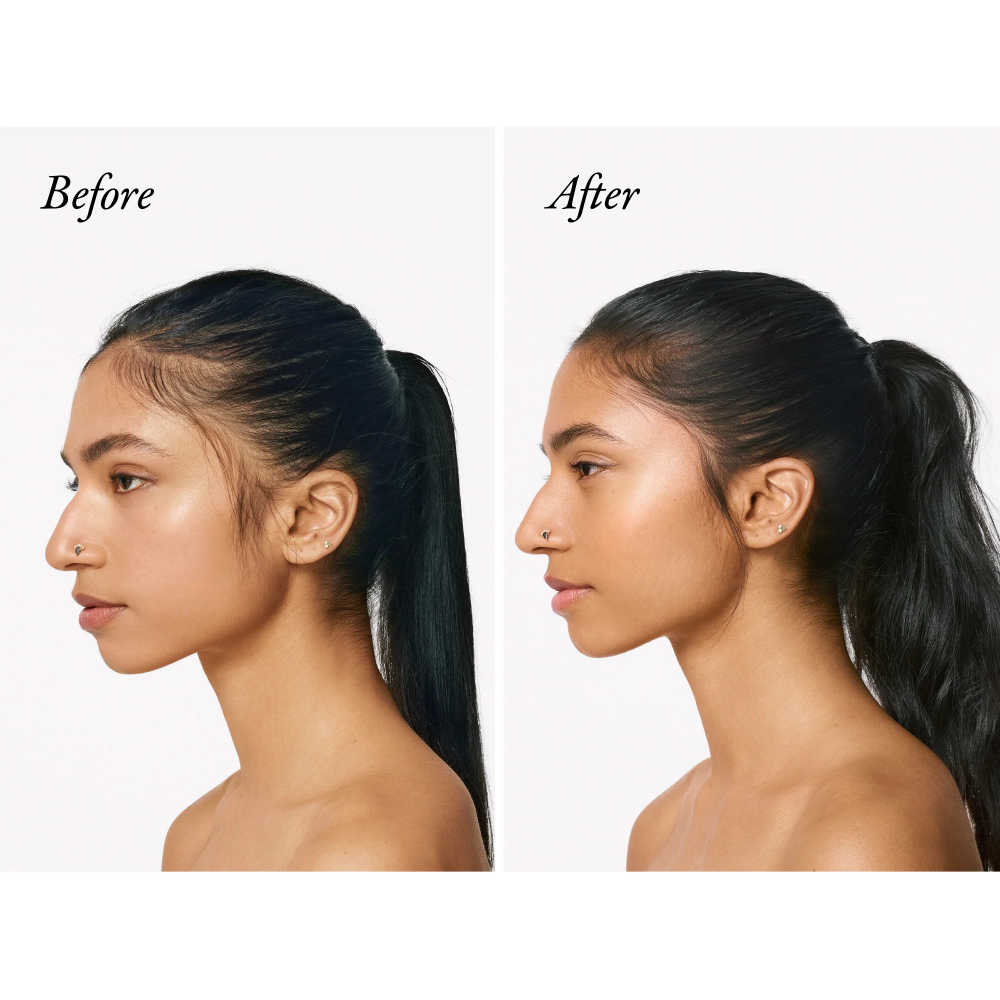 Serene Scalp Densifying Shampoo for Thicker, Fuller Hair